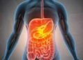 Digestive Issues: The Cause For Weight Problems