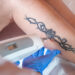 Tattoo Removal: Banish Your Youth Mistake