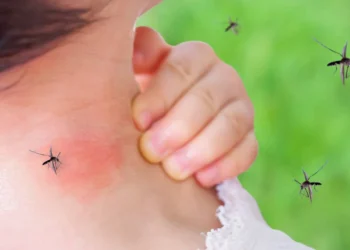 These Home Remedies Can Prevent And Treat Dengue