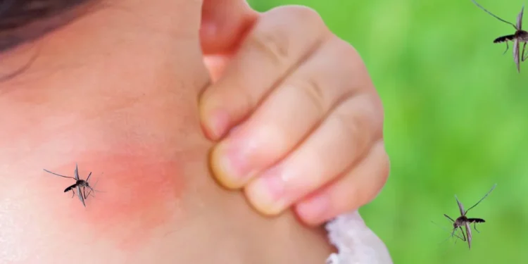 These Home Remedies Can Prevent And Treat Dengue