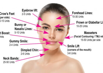 Get a pleasing facial appearance using botox injection