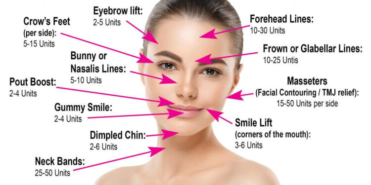 Get a pleasing facial appearance using botox injection