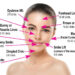 Get a pleasing facial appearance using botox injection