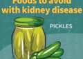 kidney match