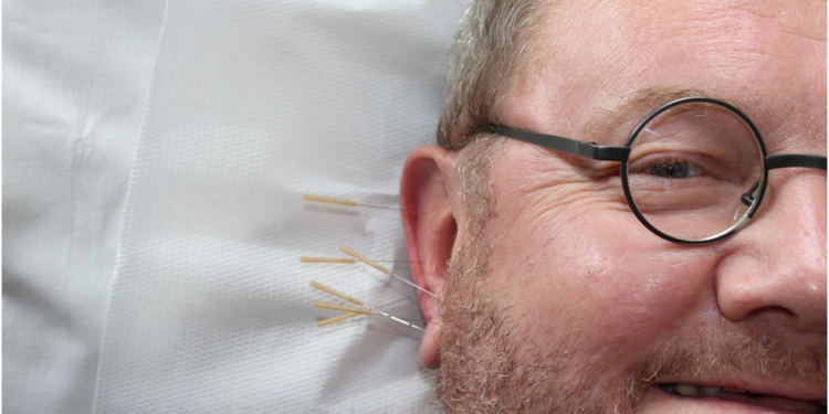 How to choose a professional acupuncturist in Ireland?