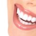 Preparing for Teeth Whitening: A Guide for Glebe Residents
