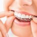 Dental