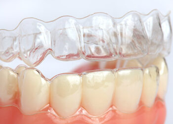 Invisalign or Braces in Los Angeles