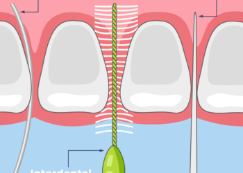 Interdental Cleaners
