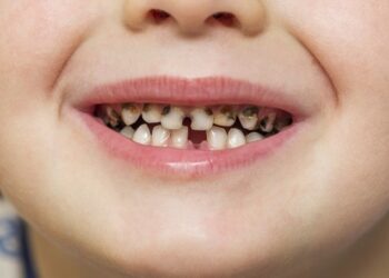 Common Pediatric Dental Issues and How to Prevent Them