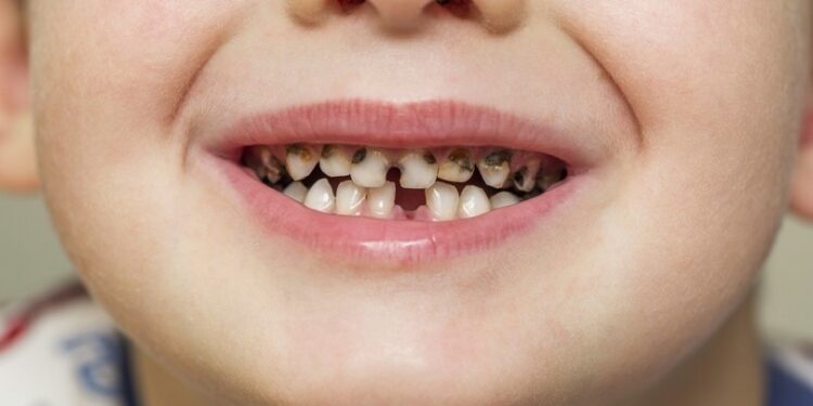 Common Pediatric Dental Issues and How to Prevent Them