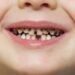 Common Pediatric Dental Issues and How to Prevent Them